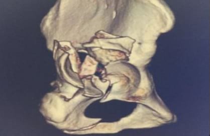 trauma services patna